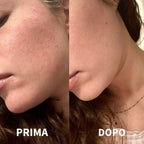 Siero Imperfezioni al Tea Tree OIL